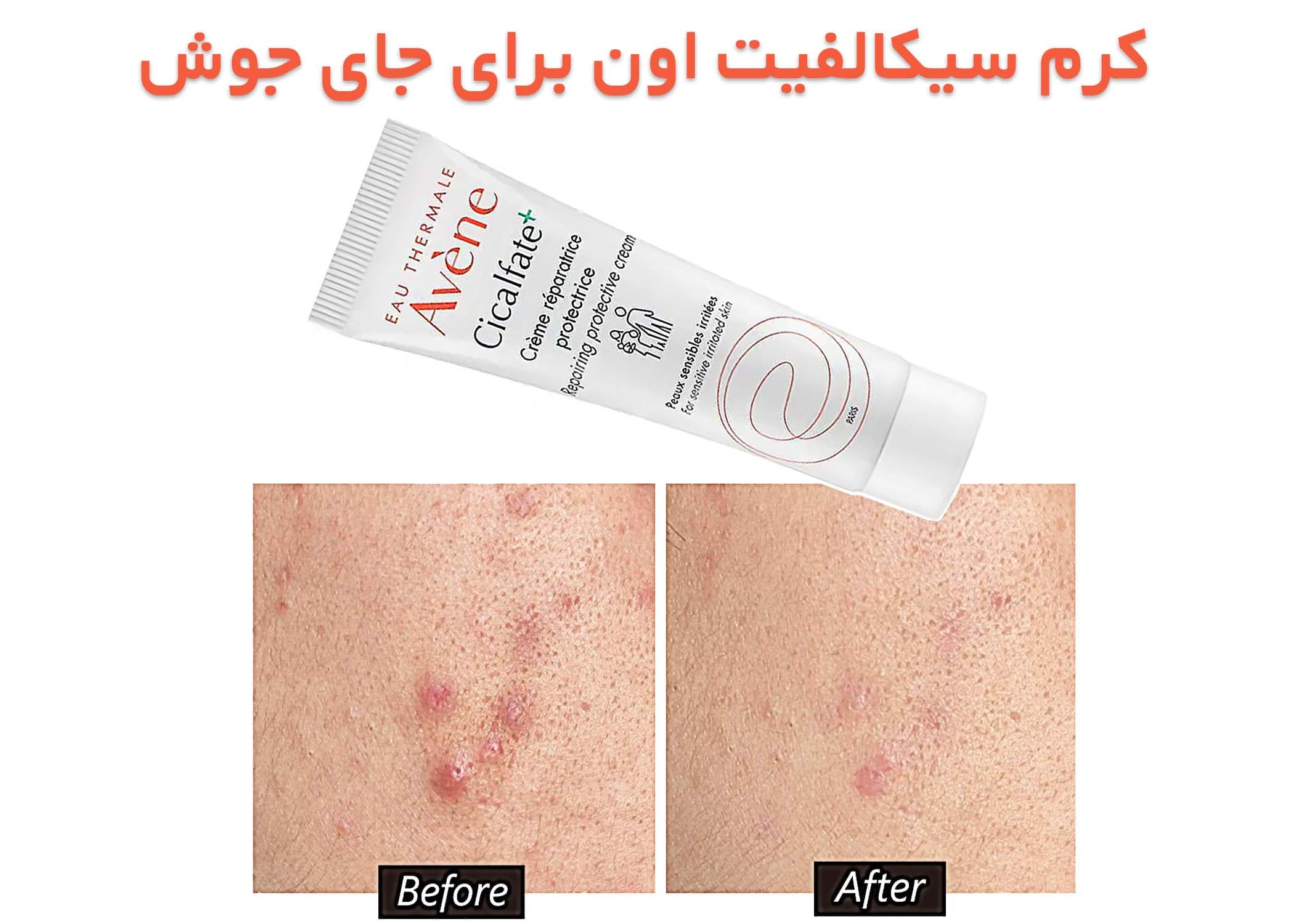 کرم ترمیم کننده جای زخم سیکالفیت پلاس اون Avene(40 میل) — تصویر ۳