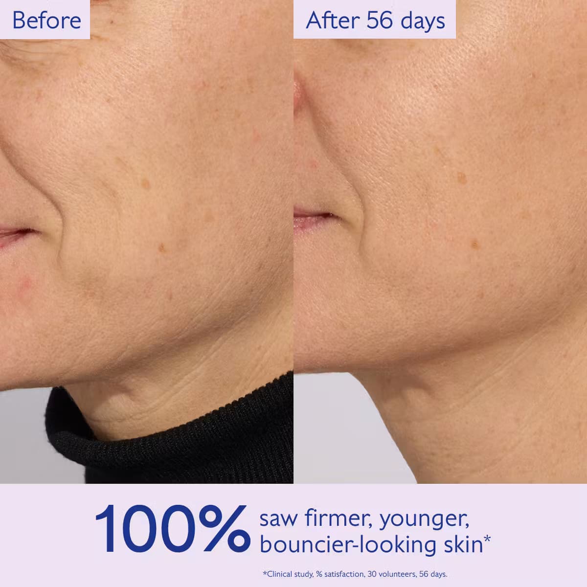 سرم لیفتینگ و سفت کننده کدلی Resveratrol-Lift حجم 30 میل — تصویر ۶