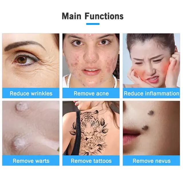 دستگاە پلاسما فیوژن نیوفیس ایکس پل X peel — تصویر ۴