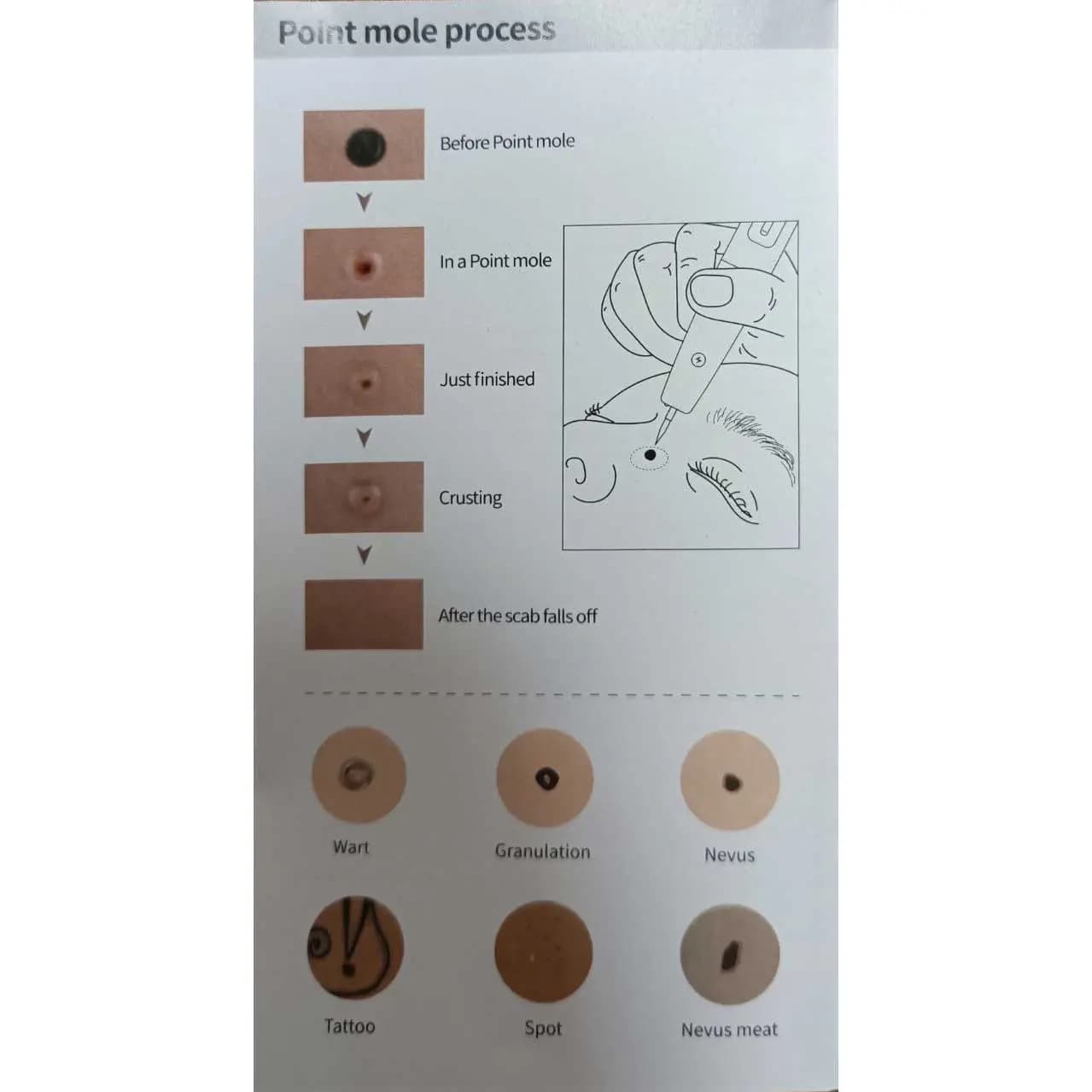 بیوتی پن 15 قدرته چراغدار مول MOLE — تصویر ۸
