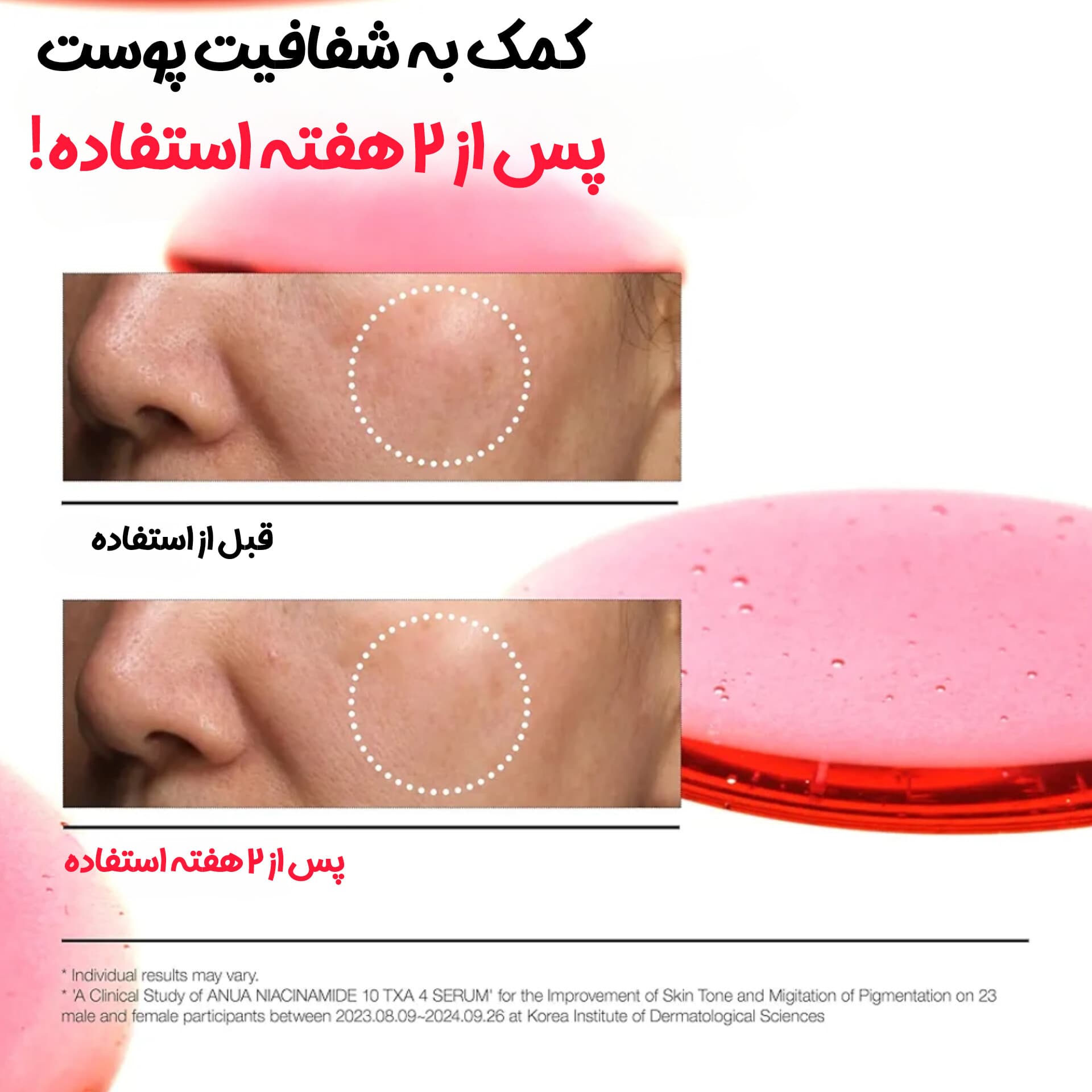 سرم ضد جوش و ضدلک نیاسینامید 10% و ترانگزامیک اسید 4% آنوا — تصویر ۶