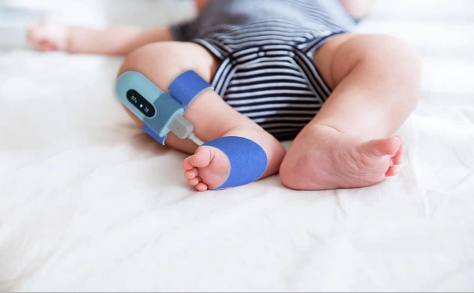 مانیتور پوشیدنی اکسیژن خون Wellue BabyO2 Baby مدل PO5 با زنگ هشدار در برنامه، مانیتور بلوتوث (برای کودکان 0 تا 3 سال) — تصویر ۵