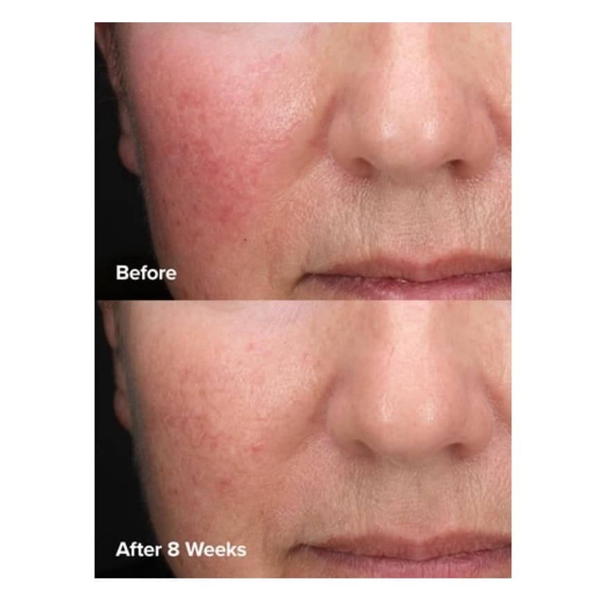 تونر پوست چرب و جوشدار پائولا چویس PAULA’S LE CHOICE XFOL IAT SKIN PERFECTING 2% BHA Liquid Exfoliant SALICYLIC ACID All Skin Types UNCLOGS & SHRINKS ENLARGED PORES SMOOTHS &EVENS SKIN — تصویر ۷