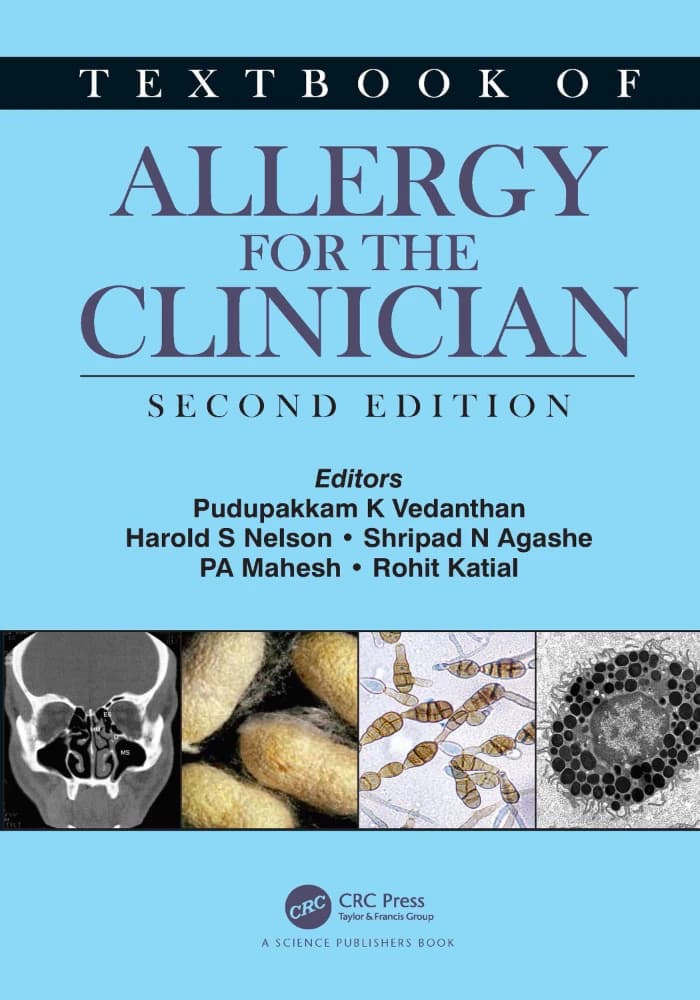 کتاب Textbook of Allergy for the clinician – 2nd ed – 2021 (کتاب درسی آلرژی برای پزشک، ویرایش دوم) نسخه انگلیسی PDF