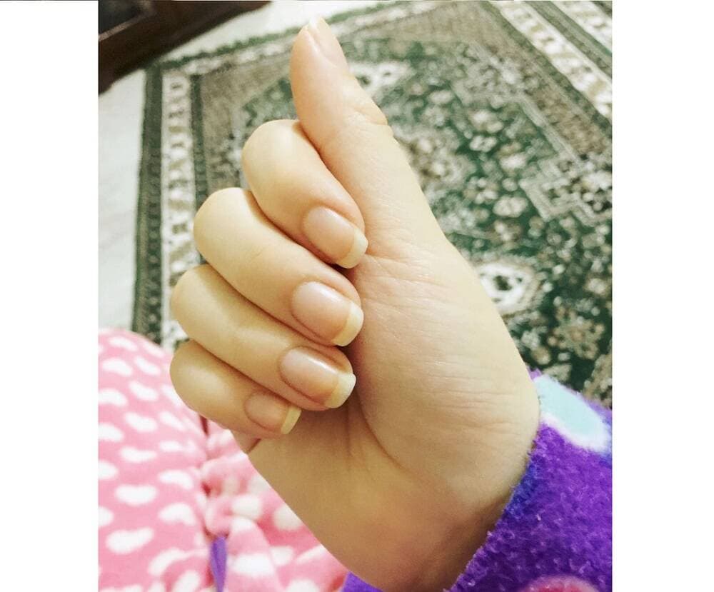لوسیون دست و ناخن کراتینه وازلین اصل | سفت کننده ناخن، نرم کننده پوست | 200 میل — تصویر ۲