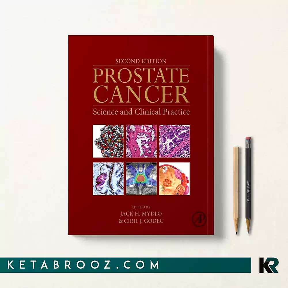 کتاب Prostate Cancer