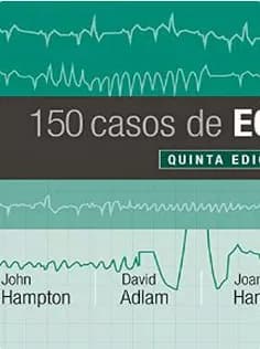 دانلود کتاب ۱۵۰ Casos De ECG