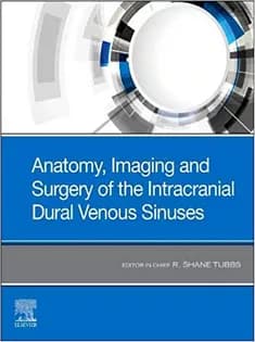 دانلود کتاب Anatomy, Imaging and Surgery of the Intracranial Dural Venous Sinuses