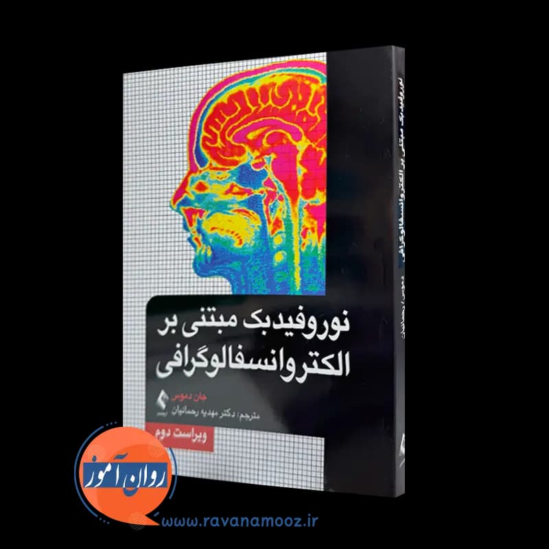 نوروفیدبک مبتنی بر الکتروانسفالوگرافی – جان دموس — تصویر ۲