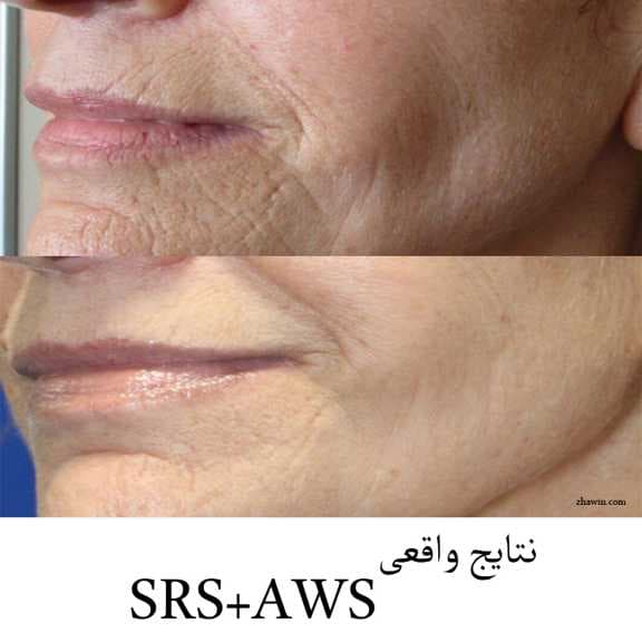 کوکتل درمانی ژنوسیس 6مدل — تصویر ۹