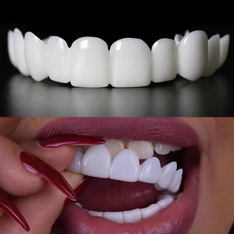 لمینت دندان دو فک مدل Snap on Smile — تصویر ۱۰