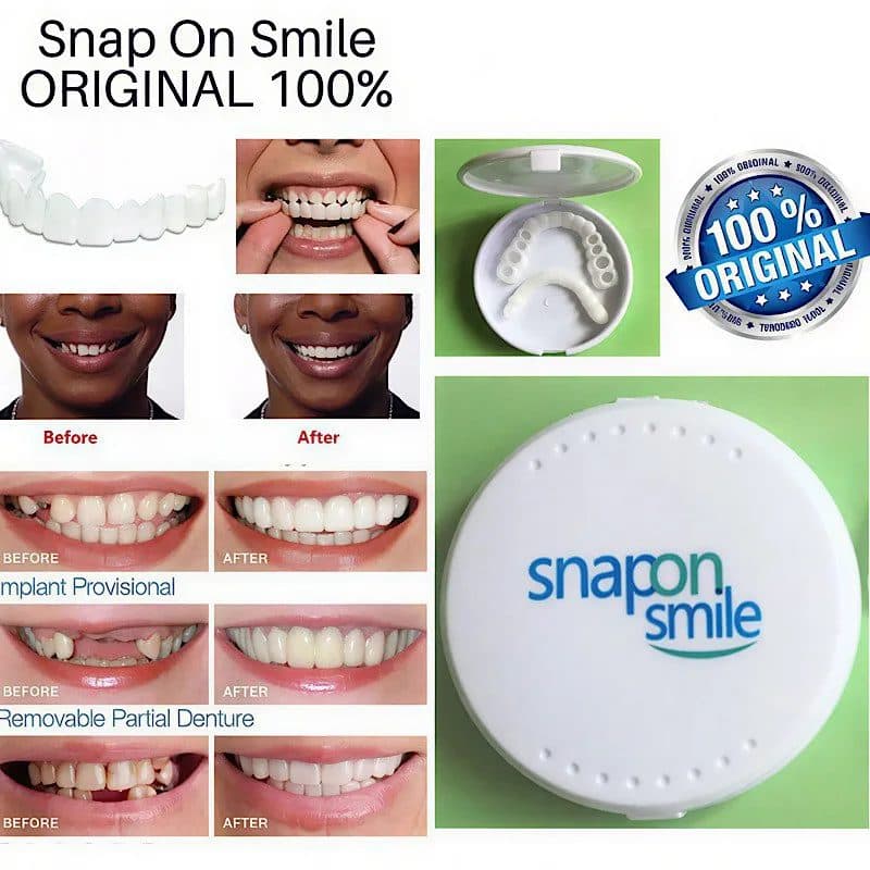 لمینت دندان دو فک مدل Snap on Smile — تصویر ۳