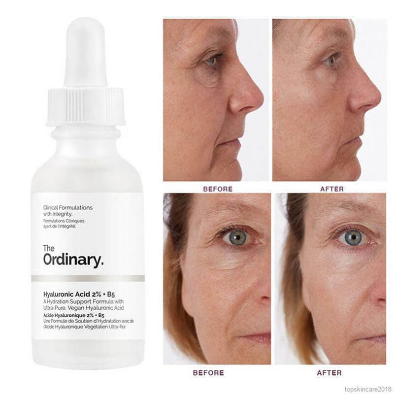 سرم هیالورونیک اسید 2% + B5 اوردینری آبرسان و جوانساز پوست — تصویر ۵