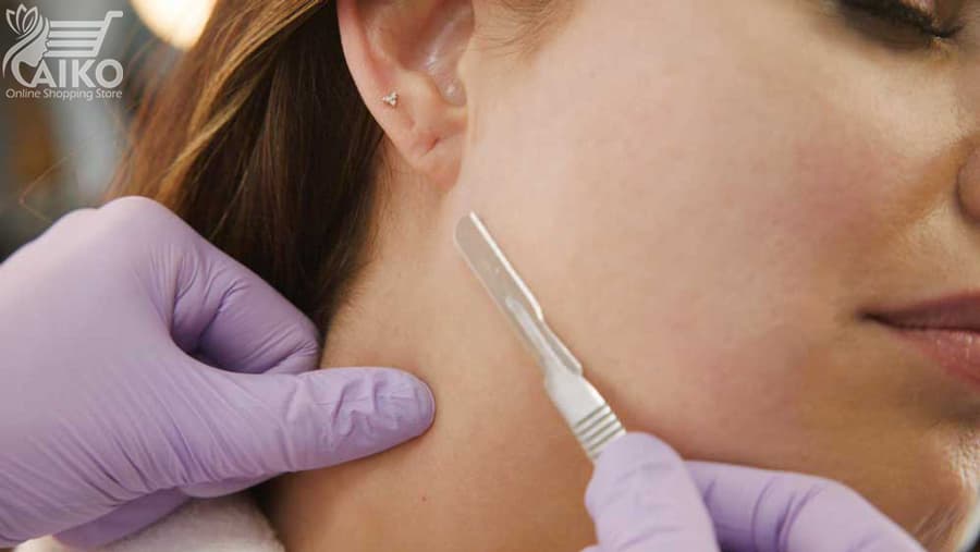 ست درماپیلینگ Dermapiling — تصویر ۷