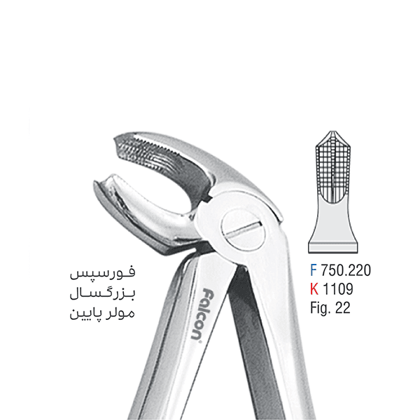 فورسپس مولر کوشافرین درمان