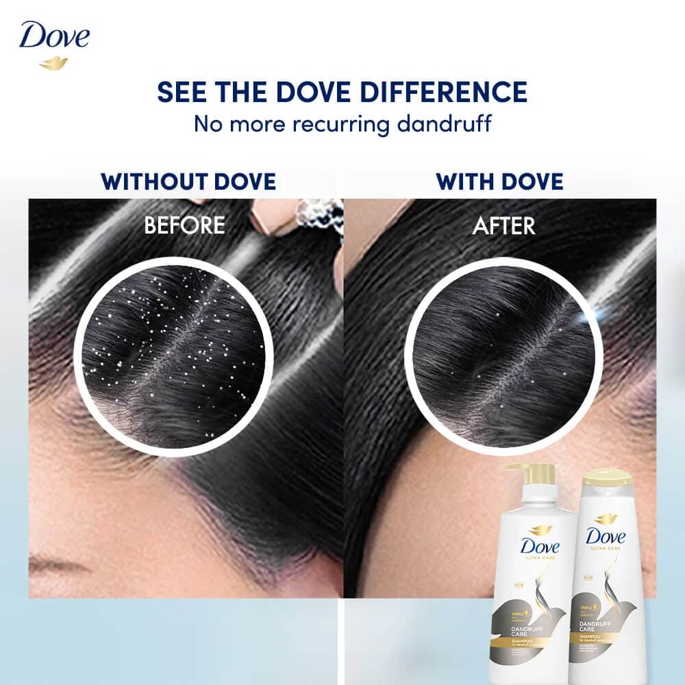 شامپو داو ضد شوره مدل DANDRUFF CARE — تصویر ۴