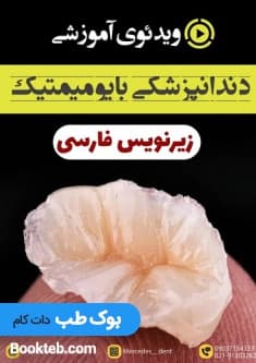 ویدئوی دندانپزشکی بایومیمتیک (زیرنویس فارسی مرسدس دنت) — تصویر ۲