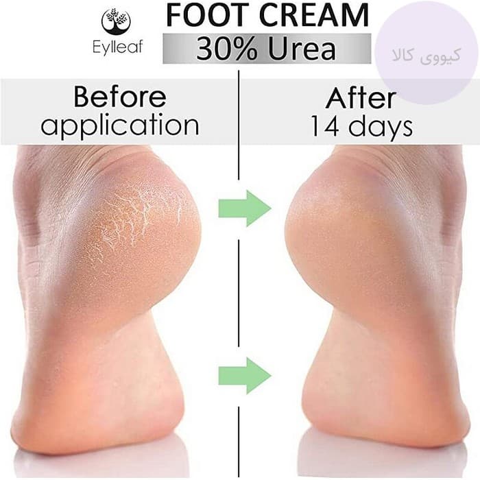 کرم پا اوسرین Eucerin مدل ترمیم کننده advanced repair — تصویر ۴
