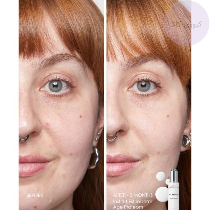 سرم ضد چروک استادرم Esthederm ایج پروتئوم age proteom — تصویر ۳
