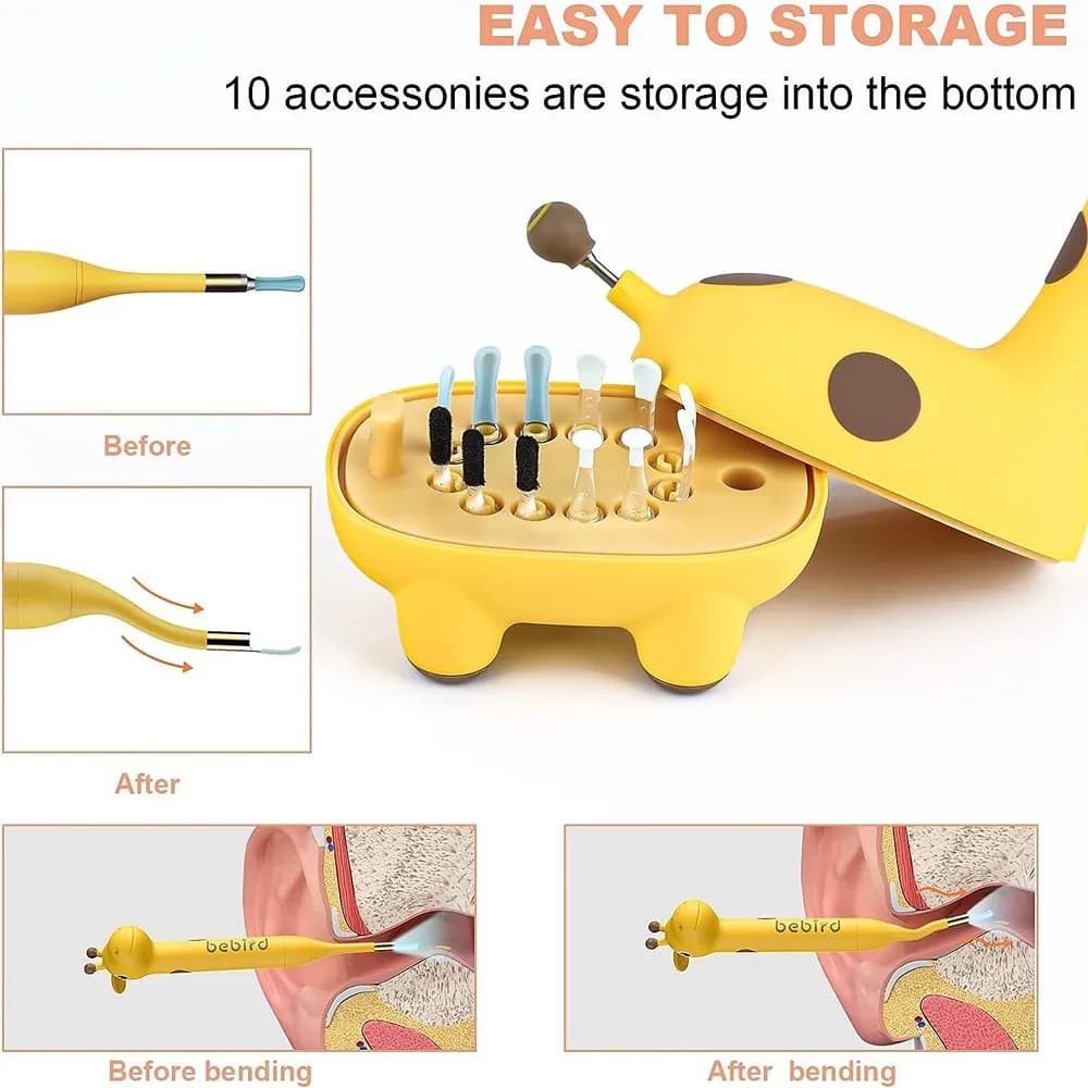 گوش پاک کن هوشمند شیائومی مدل XIAOMI BEBIRD D3 PRO SMART VISUAL EAR CLEANING TOOL — تصویر ۴