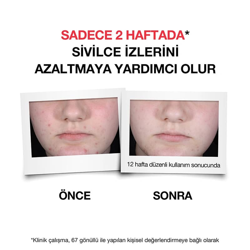 سرم ضد جوش نوتروژینا — تصویر ۳