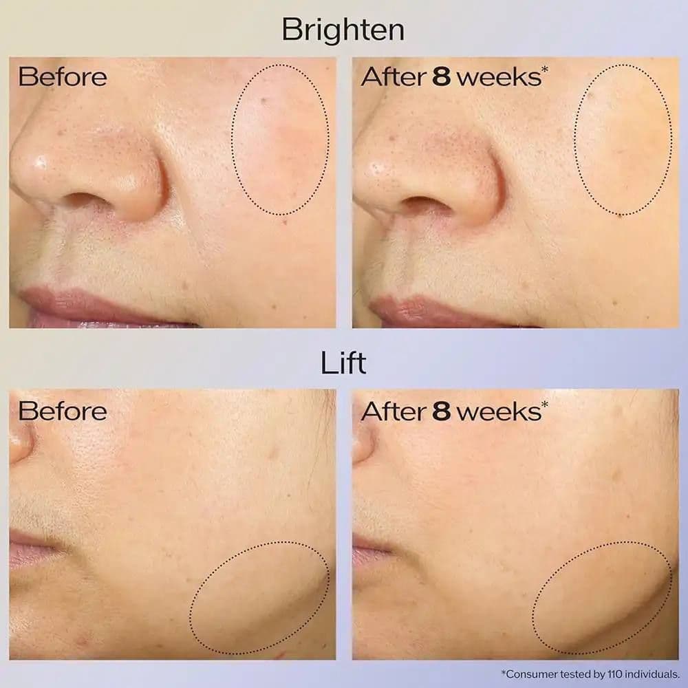 کرم ضد چروک و لیفتینگ شیسیدو Vital Perfection shiseido حجم ۵۰ میل — تصویر ۵