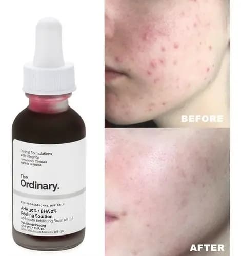 سرم پیلینگ و لایه بردار قوی اوردینری | سرم قرمز ضد لک و روشن کننده (30mL) — تصویر ۲