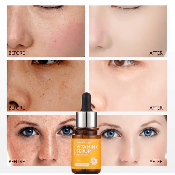 سرم ویتامین سی ویبرانت گلامور vibrant glamour vitamin c serum حجم ۳۰ میل — تصویر ۳