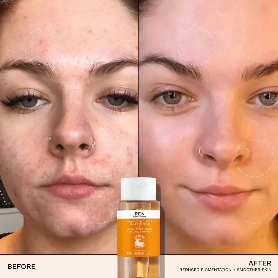 تونر لایه بردار AHA و روشن کننده پوست رن Ren Clean Skincare Ready Steady Glow Daily AHA Tonic — تصویر ۴