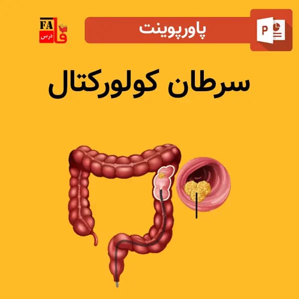 پاورپوینت سرطان کولورکتال