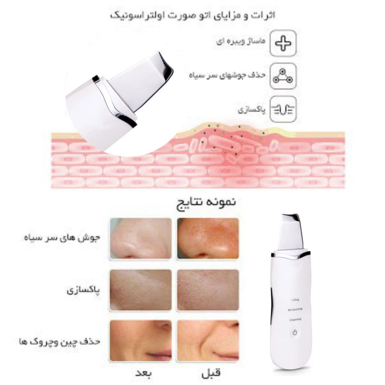 اتوی صورت مدل 8815 — تصویر ۸