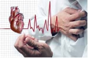 پمفلت سکته قلبی – MYOCARDIAL INFARCTION