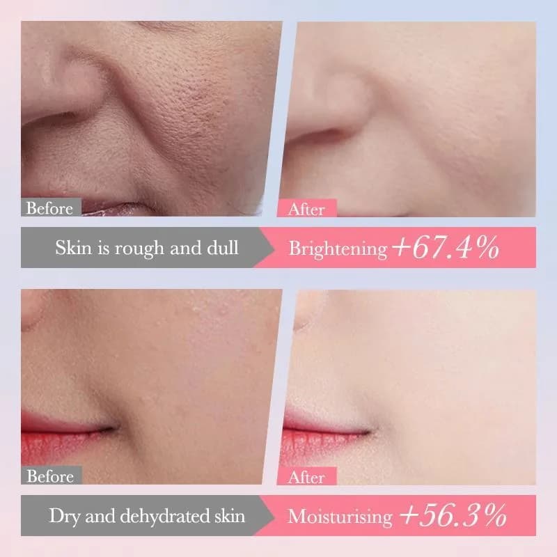 پک روتین مراقبت پوست سادور Sakura Collagen زنانه ۶ تکه — تصویر ۶