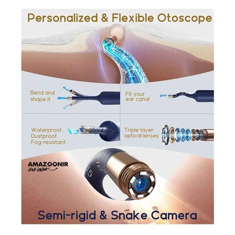 گوش پاک کن هوشمند Bebird مدل EarSight Plus — تصویر ۲