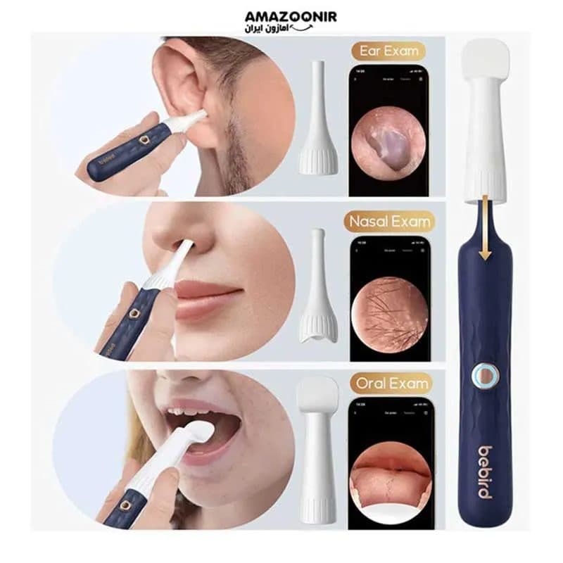 گوش پاک کن هوشمند Bebird مدل EarSight Plus — تصویر ۱۱