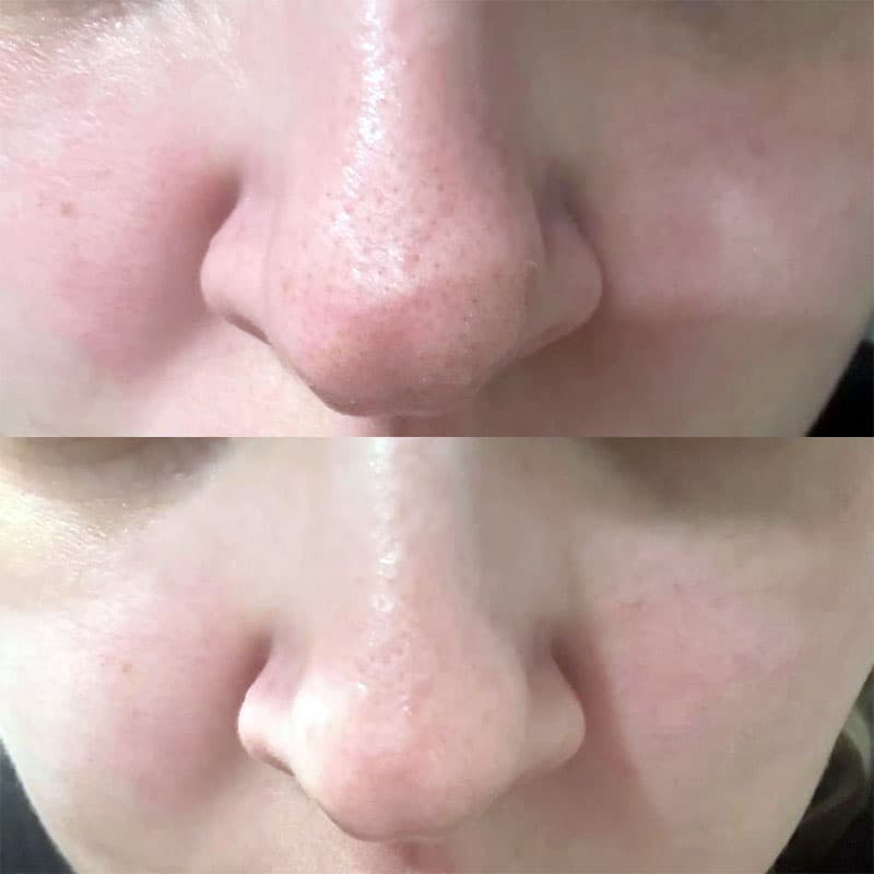 ژل کرم کنترل منافذ سنتلا SKIN1004 CENTELLA POREMIZING LIGHT GEL CREAM حجم75ml اصل — تصویر ۲