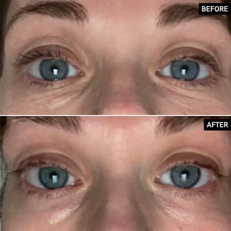 کرم دور چشم روشن کننده اینکی لیست brighten i eye cream inkey list — تصویر ۵