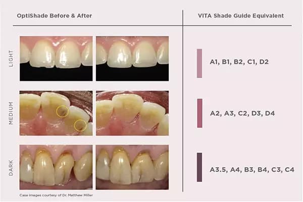 کامپوزیت اپتی شید کر – Kerr OptiShade Composite — تصویر ۲
