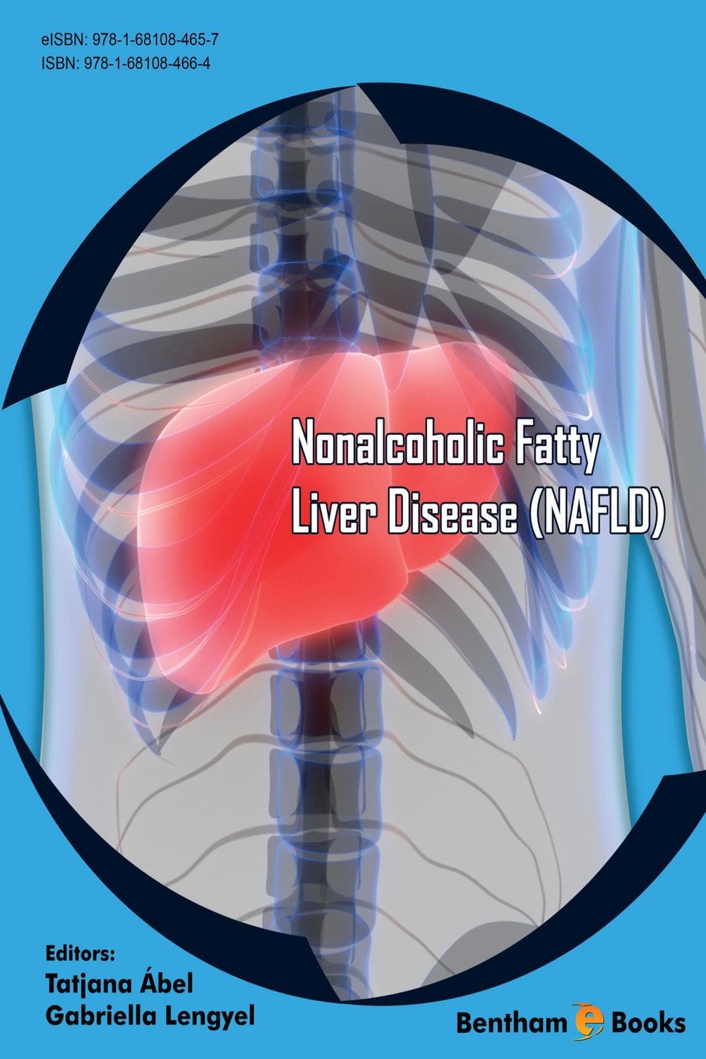 بیماری کبد چرب غیر الکلی (NAFLD) ۲۰۱۷ <br> Nonalcoholic Fatty Liver Disease (NAFLD) 2017