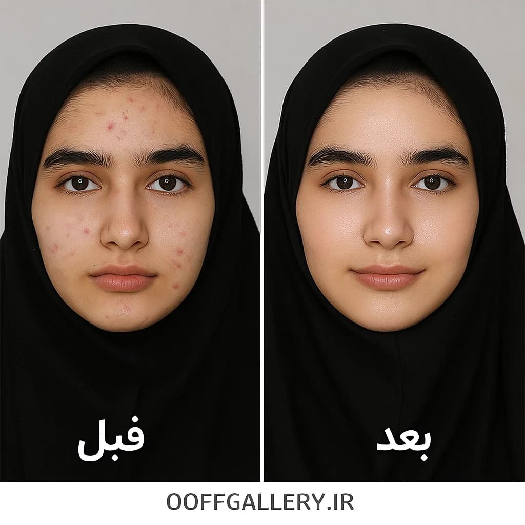 ژل شستشوی عمیق صورت نوتروژینا مدل Deep Clean مناسب انواع پوست حجم 200 میل — تصویر ۴