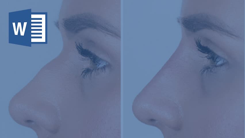 و دانلود تحقیق تزریق ژل چیست ؟کاربردها، مزایا، عوارض و هزینه