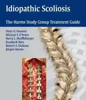 دانلود کتاب Idiopathic Scoliosis: The Harms Study Group Treatment Guide – اسکولیوز ایدیوپاتیک: راهنمای درمان گروهی مطالعه آسیب ها