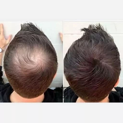 پودر پرپشت کننده موی سر پرویس 25میل — تصویر ۶