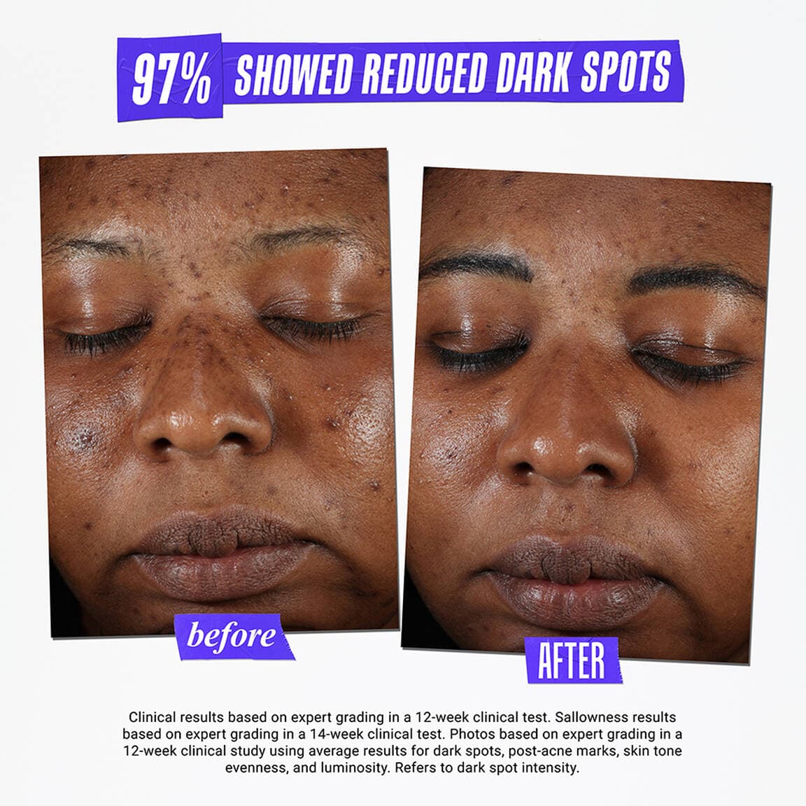 سرم ضد لک کیلز | Kiehl’s Clearly Corrective Dark spot Solution — تصویر ۴