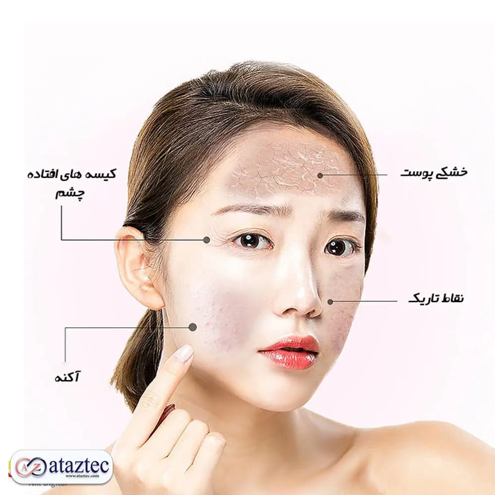 ماسک زیبایی و جوان‌کننده صورت JZC-K02-3C\7C | درمان آکنه و ضد پیری با LED سه‌گانه — تصویر ۴