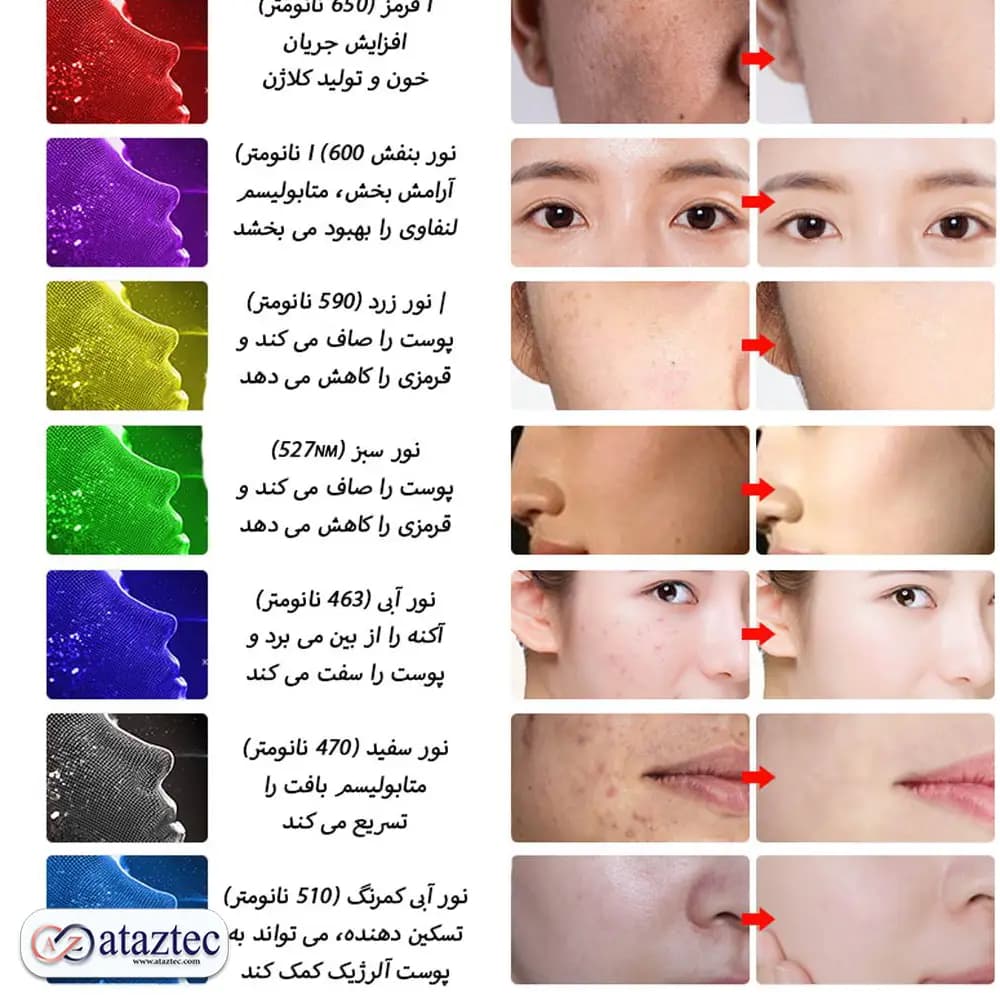 ماسک زیبایی و جوان‌کننده صورت JZC-K02-3C\7C | درمان آکنه و ضد پیری با LED سه‌گانه — تصویر ۶