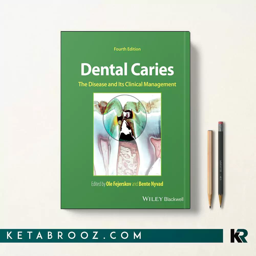 کتاب Dental Caries