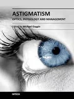 دانلود کتاب Astigmatism – Optics, Physiology and Management