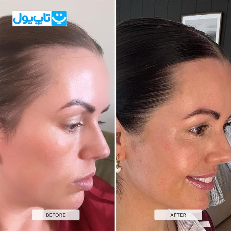 شامپو تقویتی هیربرست Hairburst مدل For longer Stronger Hair مناسب انواع مو با رایحه نارگیل و آووکادو حجم 350 میلی‌لیتر — تصویر ۵