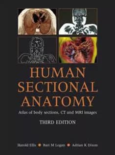 دانلود کتاب Human Sectional Anatomy Atlas of Body Sections CT & MRI Images